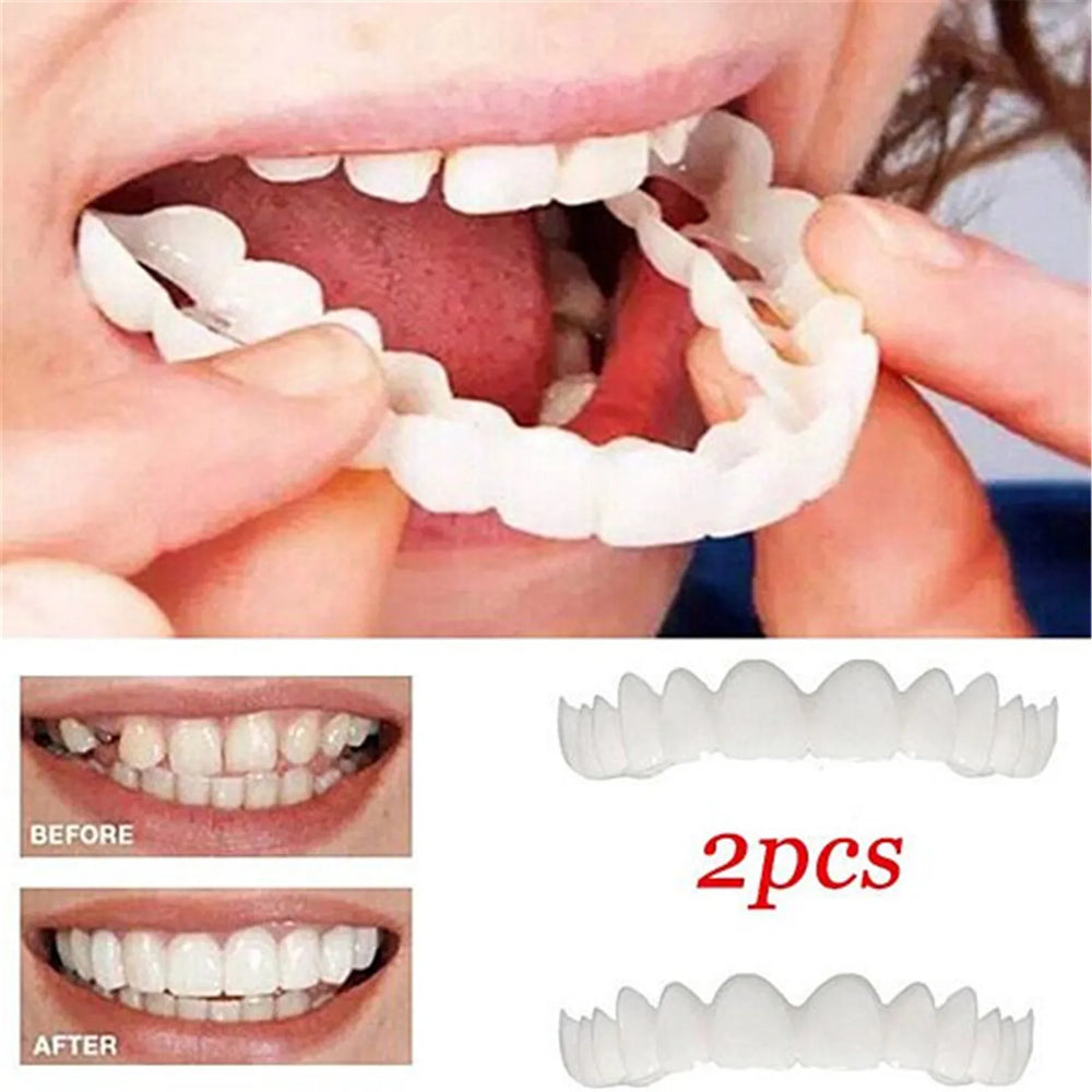 Carillas Dentales Removibles | Inferior y Superior