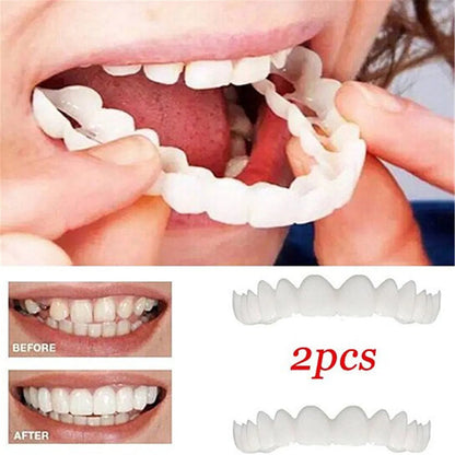 Carillas Dentales Removibles | Inferior y Superior