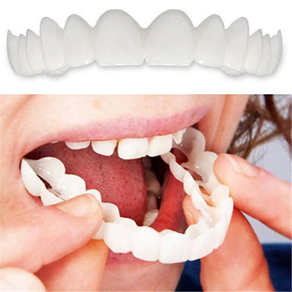Carillas Dentales Removibles | Inferior y Superior