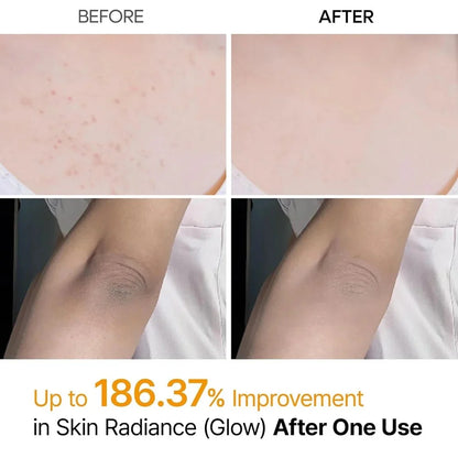 Dr. Melaxin Peel Shot Spray Exfoliante con Ácido Kójico y Cúrcuma 200 ml