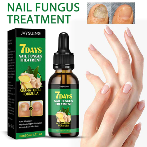Compra 1 y llevate 2👋🦠Anti Hongos Uñas - 7 Days™ 2UND 30ml