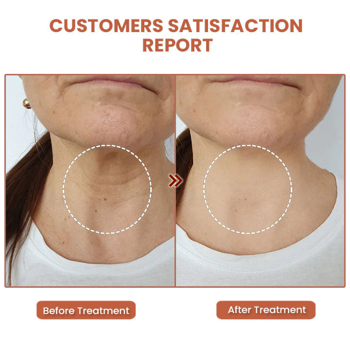 🔥70%OFF🔥SOLO HOY🔥Compra 1 y llevate 2 Bálsamo KAHI  antiarrugas