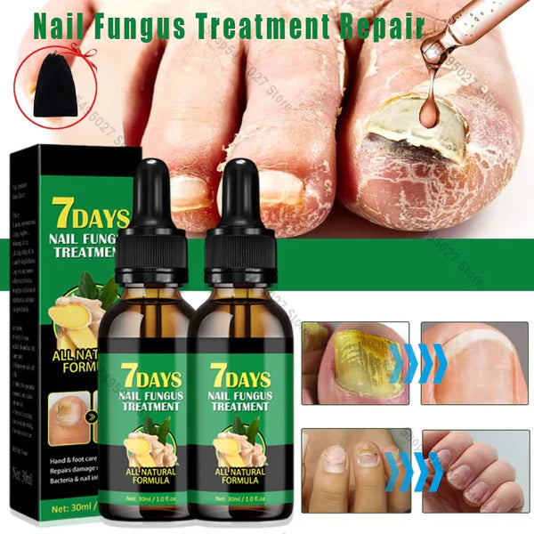 Compra 1 y llevate 2👋🦠Anti Hongos Uñas - 7 Days™ 2UND 30ml