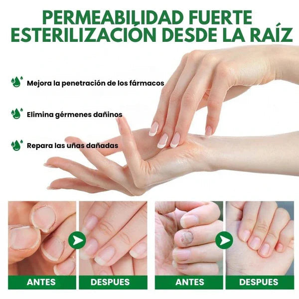 Compra 1 y llevate 2👋🦠Anti Hongos Uñas - 7 Days™ 2UND 30ml