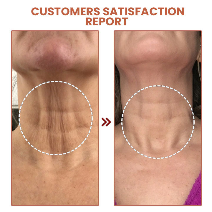 🔥70%OFF🔥SOLO HOY🔥Compra 1 y llevate 2 Bálsamo KAHI  antiarrugas